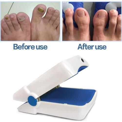 Highly Effective Rechargeable Nail Fungus Laser Treatment Device Nail Infection Onychomycosis Cure Nail Fungal Infections
