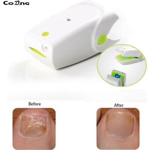 Anti Fungal Laser Device Nail Fungus Onychomycosis Laser Treatment Instrument Low Level Laser LLLT Toenails Home Use No Pain
