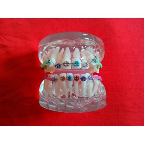 Free shipping white transparent dental tooth Orthodontists model Malocclusion orthodontic models Teaching model Dental materials
