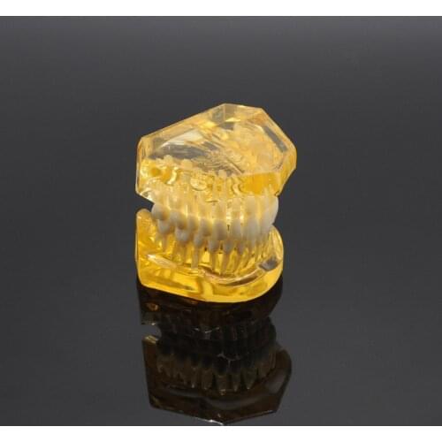Dentist Removable Teeth Model Adult Typodont Model for Dental Lab Supplies