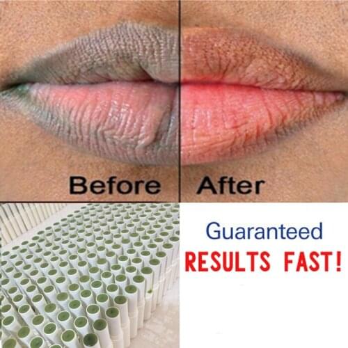 Pink Fresh Lightening Lip Cream Treatment to Remove Dark Lips