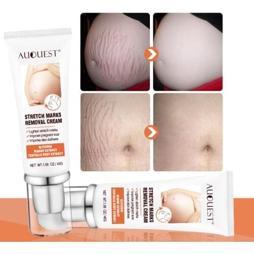 Remove Pregnancy Cream Scars Acne Marks Firming Belly Cream Cellulite/Stretch Marks Removal Maternity Slackline Skin Care TSLM1