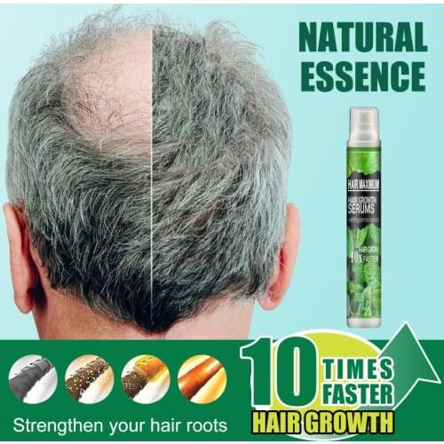 Ginger Hair Growth Serum Hair Loss Spray 7 Days Effective Germinal Hair Growth Essential Oil Men Women Hair Care 30ml TSLM1