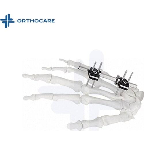 Ortho fix System Mini External Fixation Frame Orthopedic Instruments