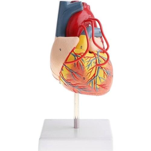 1:1 Heart Bypass Model Human Heart Bypass Model Pathological Heart Anatomical Model Educational Model Removable