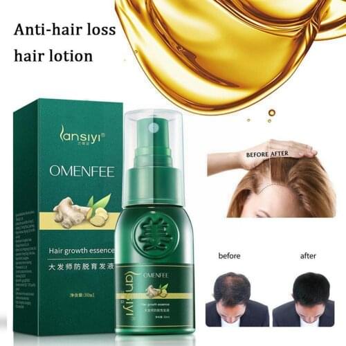 50ml Hair Nutrient Solution Anti Hair Loss Hair Growth Repair Tool Spray Dry Damaged Care Prevent Hair Frizzy Hair Hair Ser L4z2