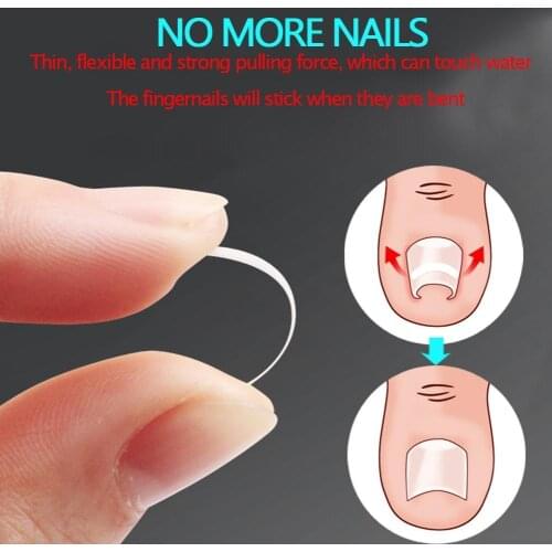 100Pcs Nail Strips Anti-roll Nail Free Glue Toe Inlay Nail Corrector Nail Patch Correction Stickers Foot Care