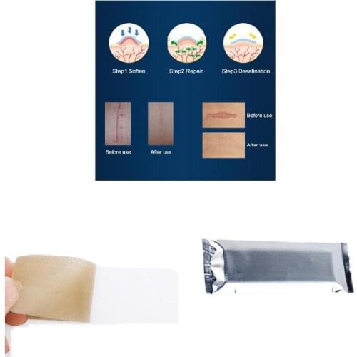 1 Pcs Silica Gel Sheeting Scar Removal Sheet Therapy Patch for Trauma Acne Pregnancy Scar TK-ing