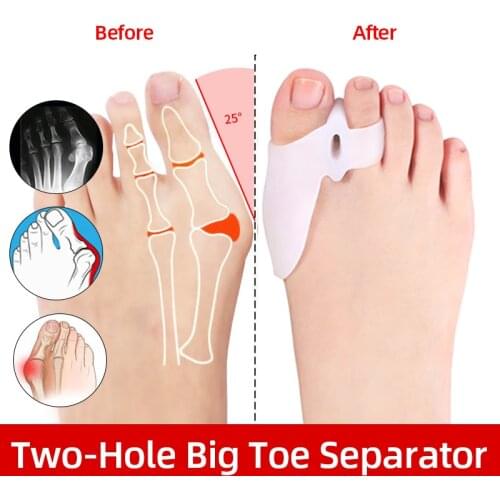 Two-Hole Toe Corrector Big Toes Separator Hallux Valgus Bunion Corrector Big Feet Bone Straightener Adjuster Soft Silicone 1Pair