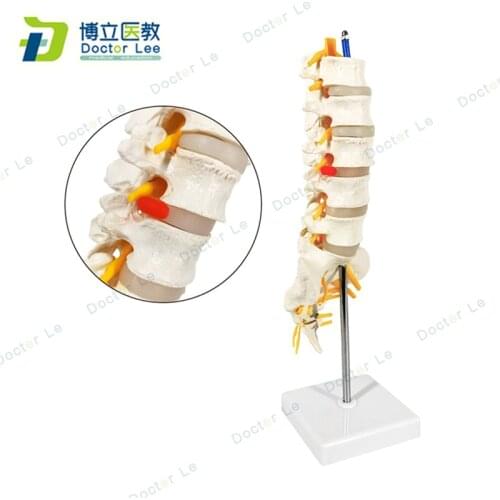 Life Size Inflexible Plastic Lumbar Vertebra Model with Spinal Nerves and Open Sacrum Bone for Medical Teaching