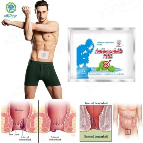 7 Pieces Anti Hemorrhoid Patch Bleeding Anus Itching Patches Piles Anal Fissure Plaster Internal/External Hemorrhoids Therapy