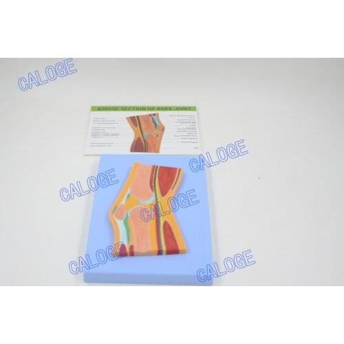 Free shipp&HumanAnatomy model MRI knee joint skeletal muscle profile medical orthopedic pain science teaching specimen