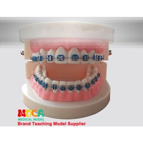 Dental models, dental materials, AIDS, orthodontics teaching dentistry MYC003