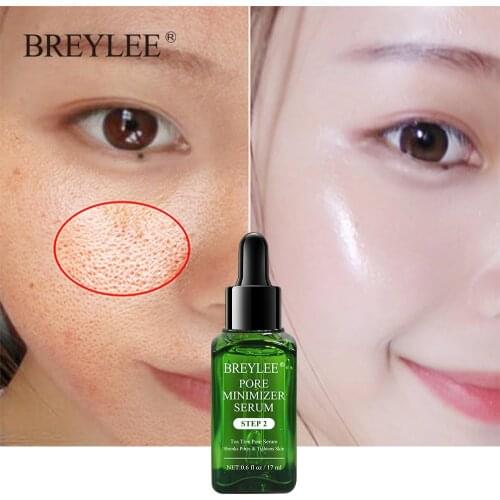 BREYLEE Blackhead Removing Pore Refining Blackhead Remover Serum Acne Treatment Shrinks Pore Peel Off Facial Cream Skin Care
