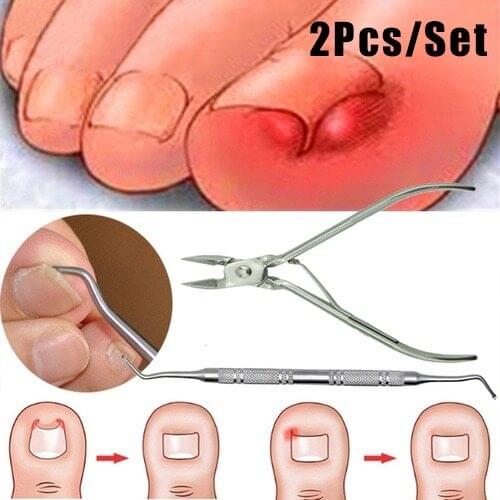 2Pcs/Set Ingrown Toe Nail Correction Nippers Clipper Cutters Dead Skin Dirt Remover + Paronychia Podiatry Pedicure Care Tool