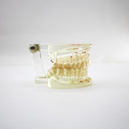 Half side can be temovable model Dentist Teaching Study Typodont Demonstration Tool Standard Adult Teeth Model