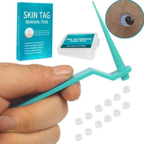 1set Skin Tag Kill Skin Mole Wart Remover Micro Skin Tag Removal Kit With Cleansing Swabs Adult Mole Wart Face Care