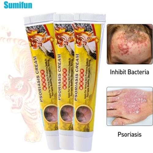 3pcs Sumifun Tiger Balm Ointment Skin Care Treatment Eczema Psoriasis Dermatitis Chinese Herbal Antibacterial Cream Anti Fungal