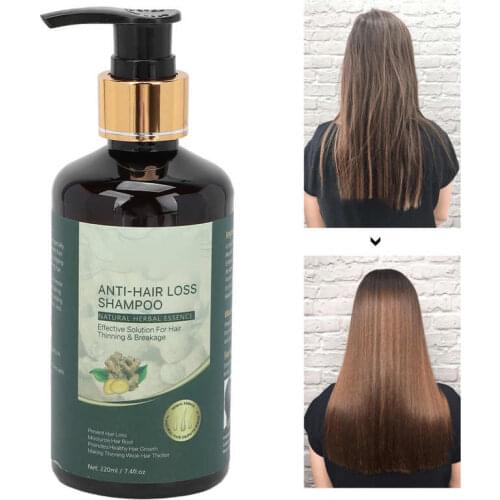 Шампуни от перхоти TMISHION China At AliExpress