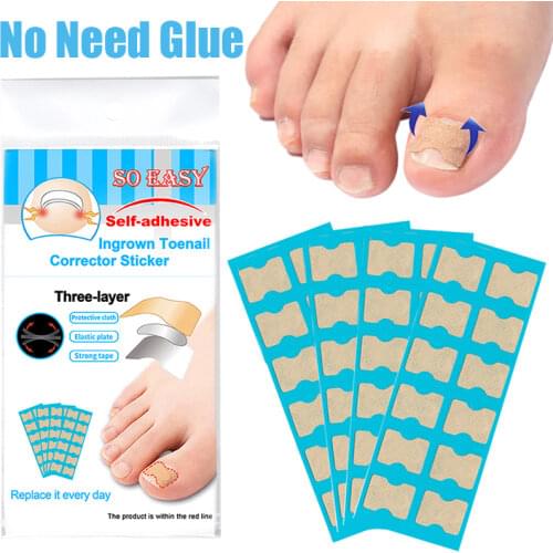 36/48/60pcs Non Glue Toe Nail Patches Ingrown Toenail Correction Stickers Nail Treatment Care Elastic Sticker Pedicure Tools
