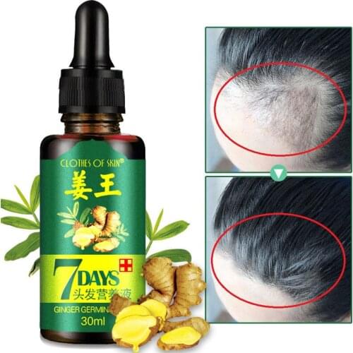 7 Days Ginger Essence Hairdressing Hairs Mask Hair Essential Oil Hair Care Oil Essential Oil Dry and Damaged Hairs Nutrition