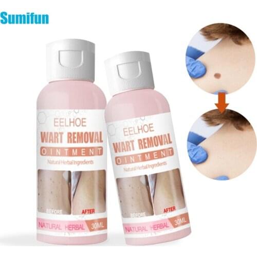 30ml Warts Removal Ointment Corn Skin Tag Remove Cream Wart Treatment Herbal Extract Medical Plaster Skin Whitening Care