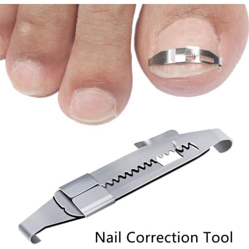 Ingrown Toe Nail Correction Tool Toenail Straightening Correctors Patch Tool Straightening Clip Brace Pedicure Tool