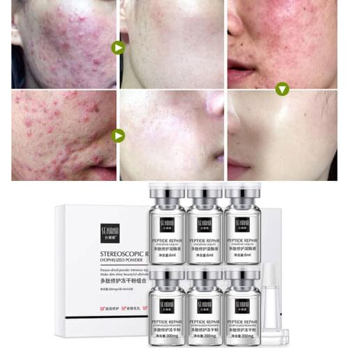 Face Serum Anti-wrinkle Anti-acne Moisturizing Repair Brighten Firm Anti-aging Nourish Oligopeptide-1 Polypeptide Skin Care Set