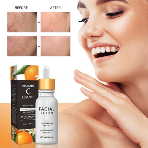 Сыворотки с витамином С для лица Ashowner China At AliExpress