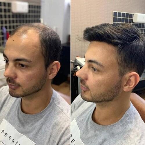 Non-surgical Men Hair System 0.08-0.1mm V Loop Thin Skin Toupee Hair Replacement System Straight Hair Mens Wigs