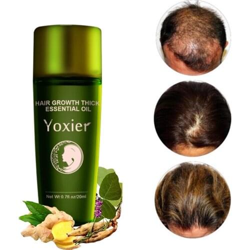 New Hair Growth Essence Oil Effective Extract Anti Nourish Hair Roots Treatment Preventing Hair Loss Hair Care Products