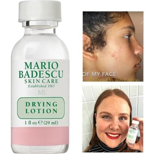 New 30ml Pimple Blemish Remover Effective Acne Treatment Mario Badescu Drying Lotion Anti Acne Serum