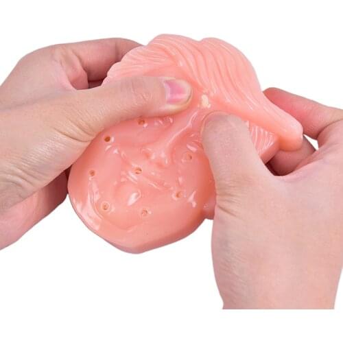 1Pc Desolakly Squeeze Acne Toys Funny Toy Pimple Popping Set Kit Popper Remover Stop