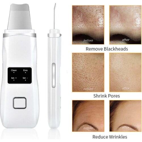 Ultrasonic Skin Scrubber Deep Face Cleasing LCD Machine Peeling Shovel Facial Pore Cleaner Lift Acne Blackhead Remover Massager