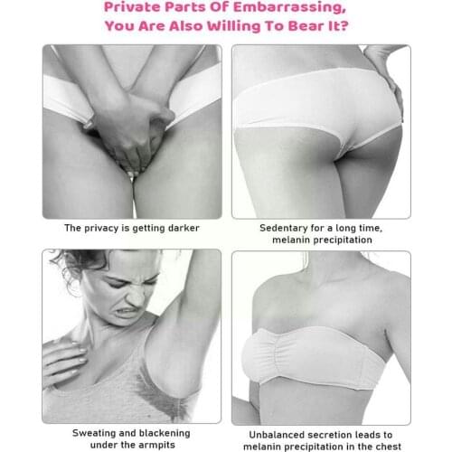 Whitening Cream Niacinamaide Face Body Bleaching Cream White Knees Underarm Legs Cream Cream Parts Body Private Body Armpit J6R4