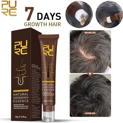 PURC Natural Hair Growth Essence Fast Growing Hair Products Hair Loss Treatment Hair Care for Men Women Dense Hair Growth 20g