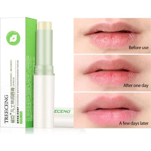 1 Pc Vaseline Lip Balm Moisturizing Moisturizing Lipstick Repair Anti-chapped Lip Care Men And Women Lipstick TSLM1