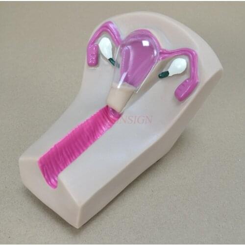 Intrauterine device Female intrauterine contraceptive device and training model uterine reproductive organ teaching mold