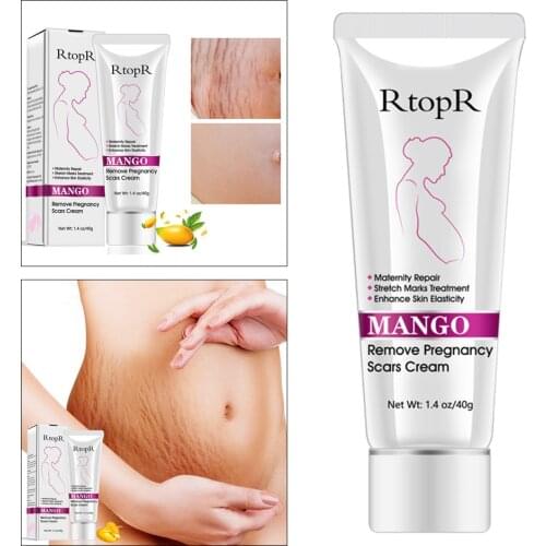 Rtorp Remove Pregnancy Scars Cream Maternity Repair Anti Winkle Skin Firming Treatment Slack Abdomen Acne Body Cream Treatment