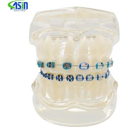 NEW Arrival Dental Orthodontics Typodont Teeth Model Half Metal Half Ceramic Brace bracket Typodont with Arch Wire