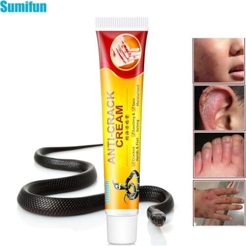 1pcs Anti-Chapping Ointment Repair Skin Ointment Frozen Frostbite Feet Calloused Heels Pain Relief Itch Natural Skin Care P1196