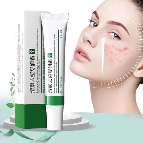 Effective Acne Removal Cream Acne Treatments Fade Acne Spots Oil Control Shrink Pores Whitening Moisturizing Cream Skin Care 1PC