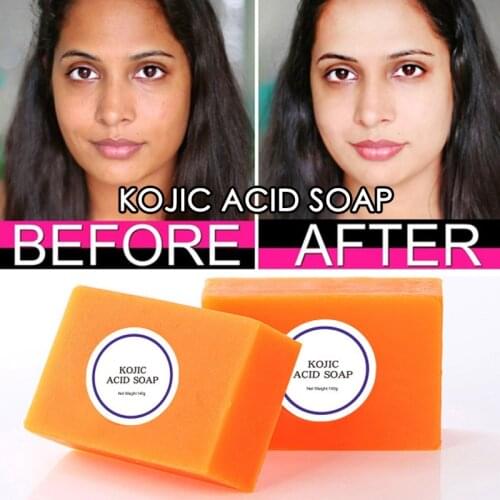 Dark Black Kojic Acid Soap Skin Lightening Soap Hand made Soap Glutathione Whitening Soap Skin Bleaching Soap Brighten Face100g