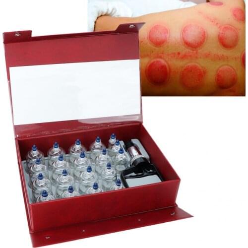 19pcs Suction Cups Jar Vacuum Cupping Set Massager Therapy Cupping Tools for Body Massage