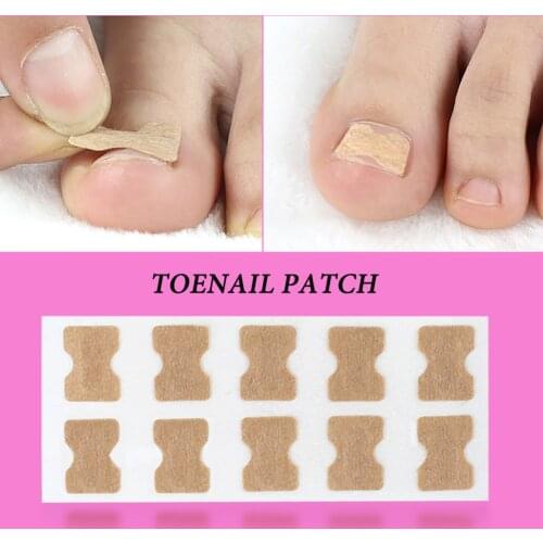 Ingrown Toenail Corrector Sticker Paronychia Treatment Recover Corrector Corrector Pedicure Foot Toe Nail Care Tool Glue Free