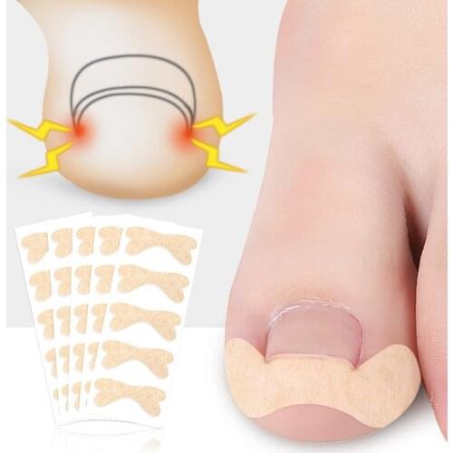 20pcs Ingrown Toenail Corrector Sticker Paronychia Treatment Fixer Recover Corrector Bunion Pedicure Foot Toe Nail Care Tool