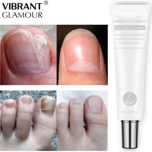 VIBRANT GLAMOUR 20g Nail ToeRepair Cream Nail Fungus Treatment Onychomycosis Removal Anti Fungus Cream Nail Care TSLM1
