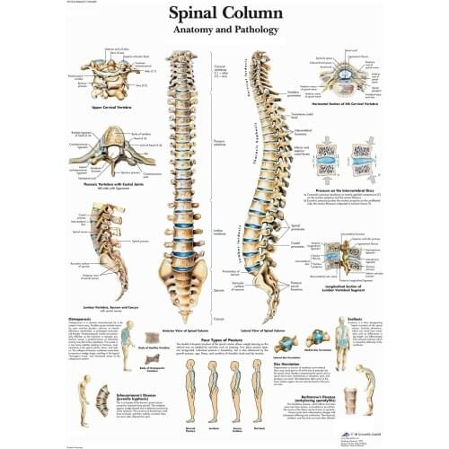 ANATOMICAL SPINAL COLUMN DIAGRAM HUMAN CHART SPINE ANATOMY Art Film Print Silk Poster Home Wall Decor 24x36inch