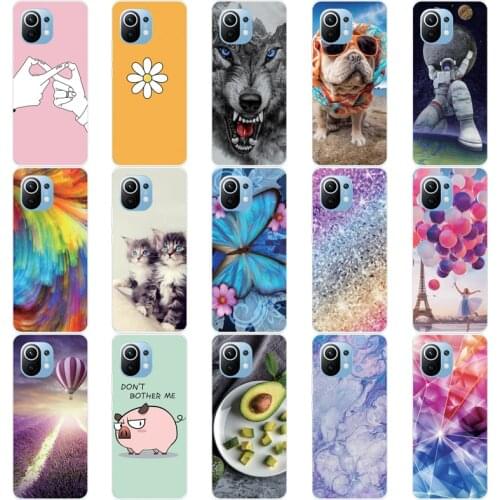THREE-DIAO Xiaomi Mi 11 Phone Cases