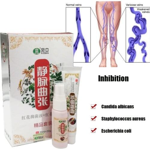 20G Varicose Vein Cream+20ML Varicose Spider Spray Treatment Relief Pain From Legs Body Varicosity Angiitis Medical Plaster
